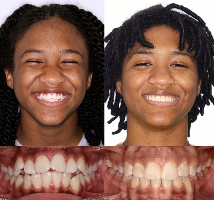 Annapolis Orthodontics in Annapolis, MD