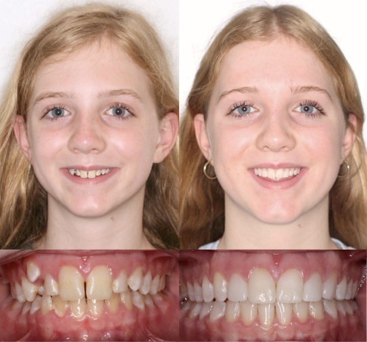 Annapolis Orthodontics in Annapolis, MD